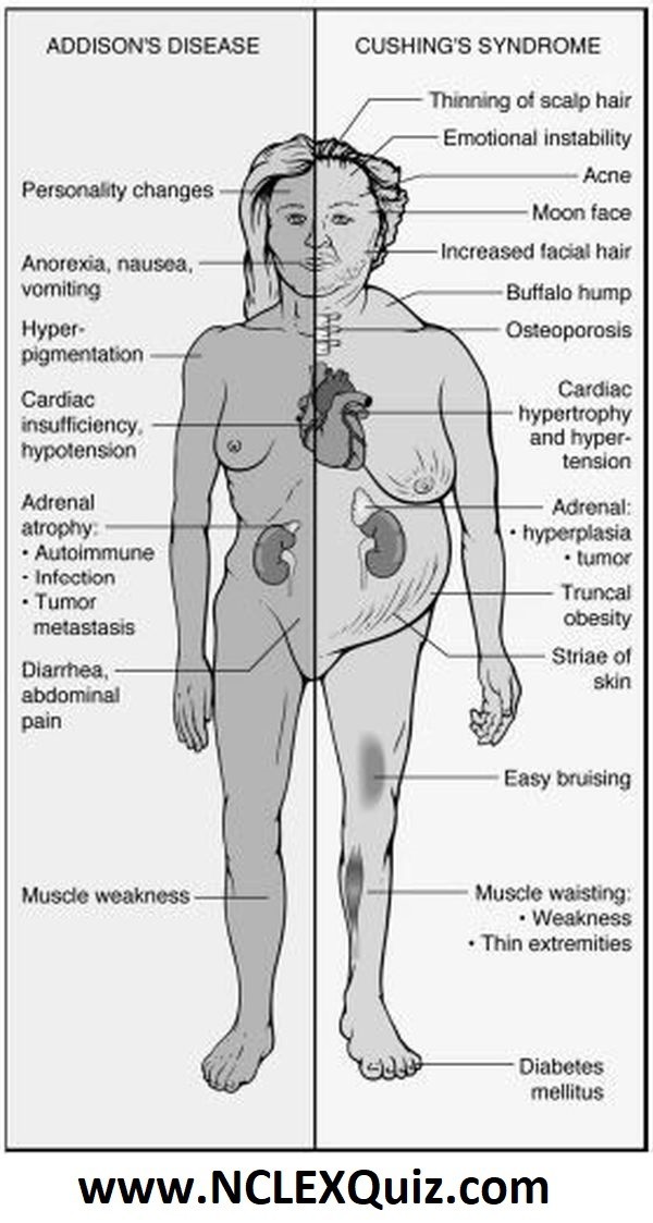 Addisons-Disease-vs-Cushings-Syndrome.jp