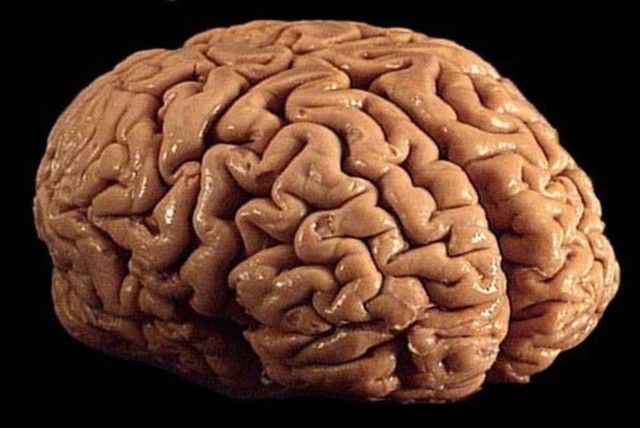 brain-800x536.jpg